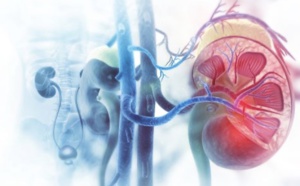 Insuffisance rénale : Un nouveau modèle intégratif et dynamique de prédiction de la perte du greffon